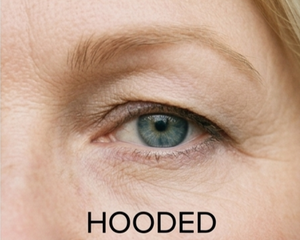 Hooded Eyes<a href="/collections/natural-everyday" title="Natural Everyday">/collections/natural-everyday</a>